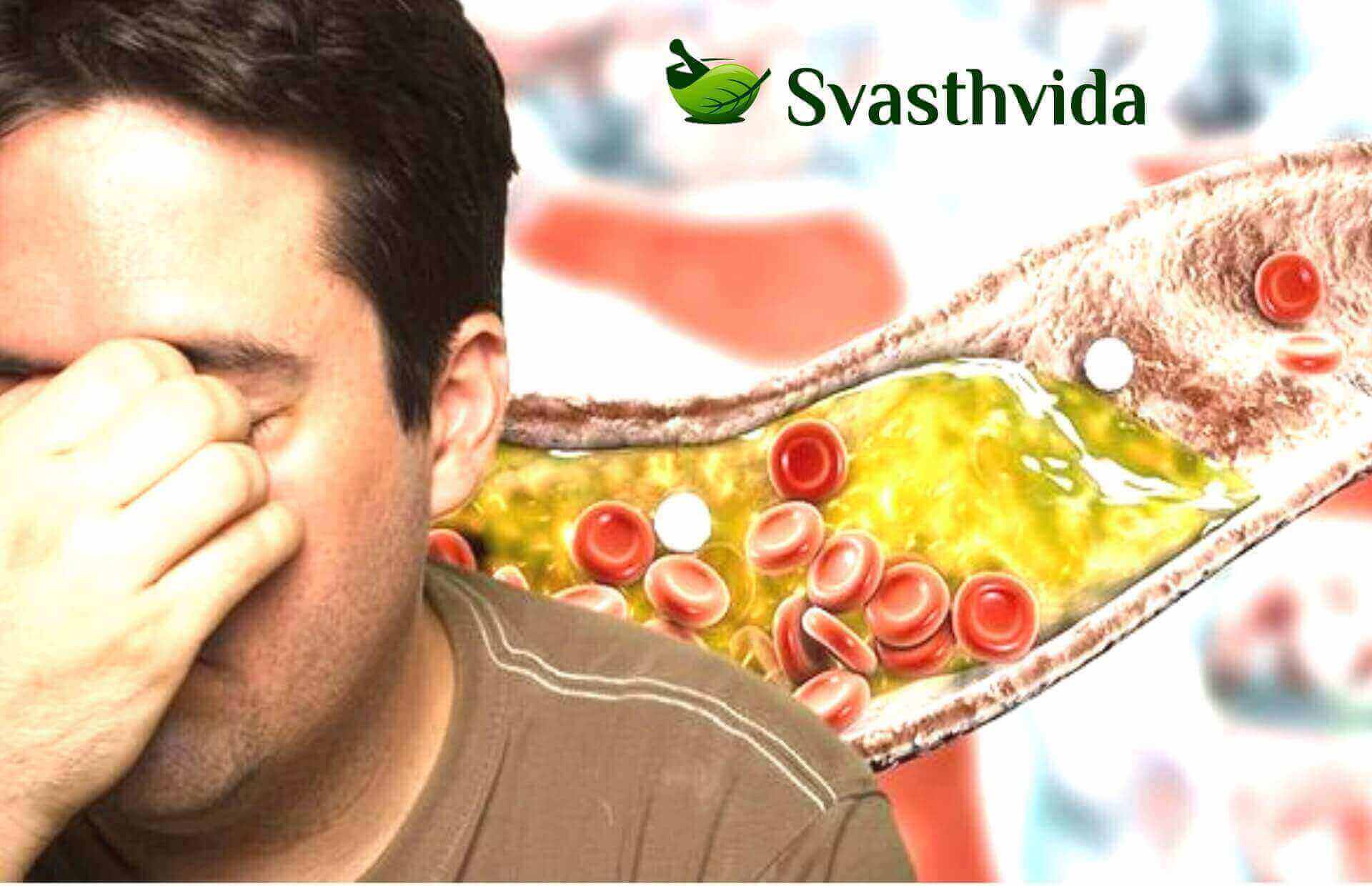 Ayurvedic Treatment For High Cholesterol In India