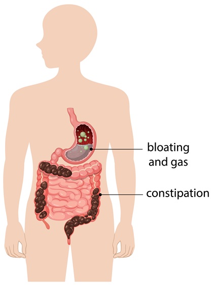 Why Am I Always Bloated? Common Causes and What to Do Bloating and gas