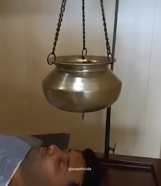 शिरोधारा