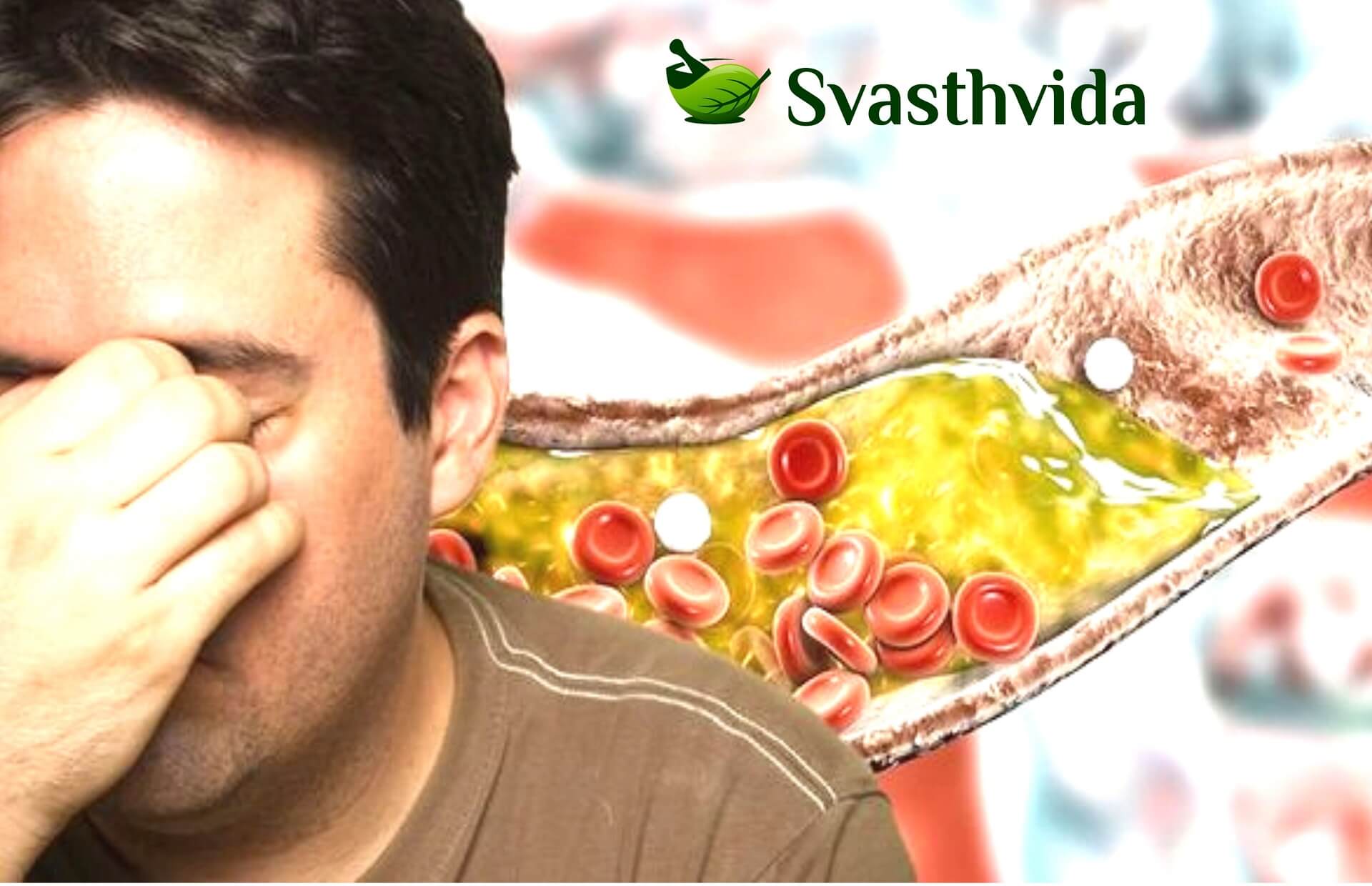Ayurvedic Treatment For High Cholesterol In Chaoke